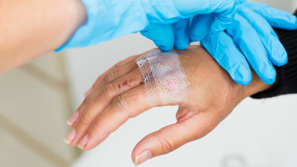 Formation pour infirmiers sur la gestion des plaies et la cicatrisation