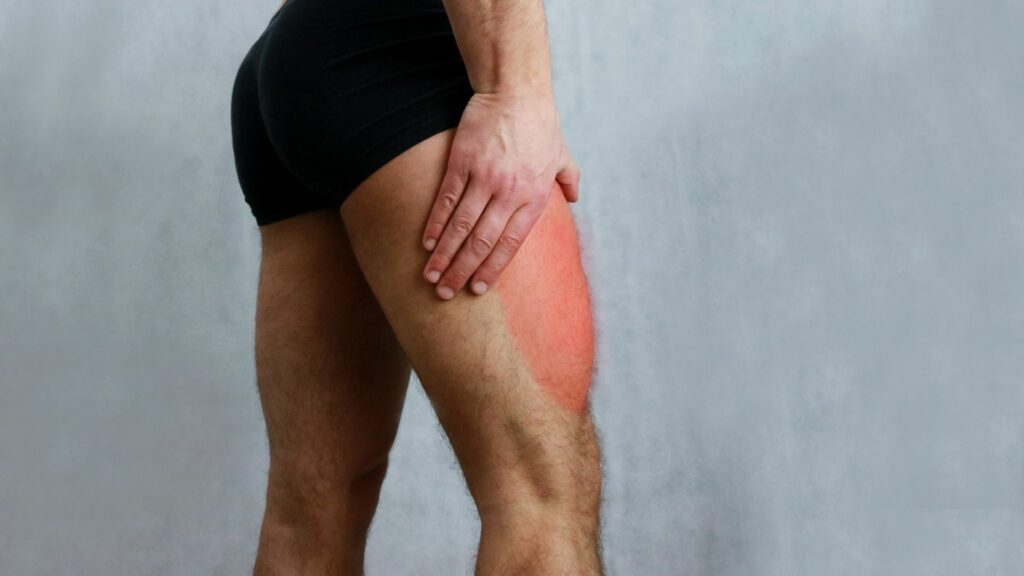 Formation kiné sur les lésions musculaires